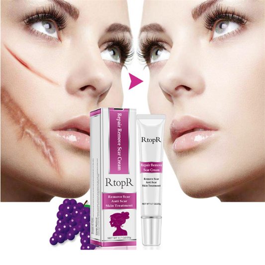Acne Scar Removal Cream for Skin Repair and Healing